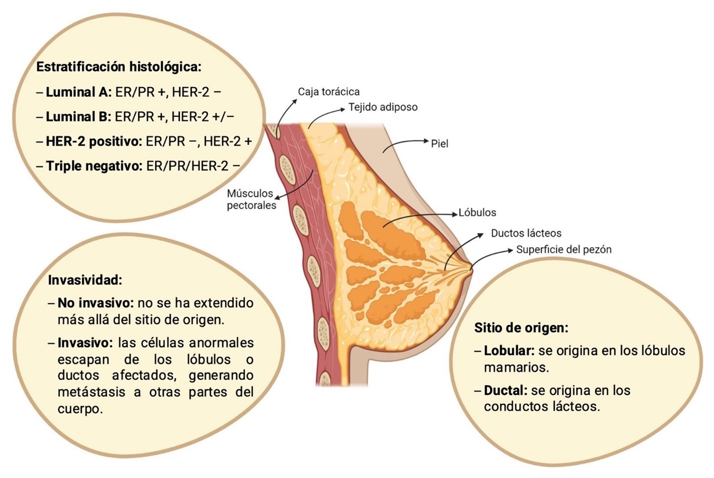 Clasificación cáncer de mama